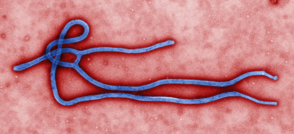 صورة مجهرية لفيريون فيروس الإيبولا - وهو جزء من الفيروس قادر أيضًا على إصابة المرض. من ويكيبيديا، سينثيا جولدشميت، مركز السيطرة على الأمراض