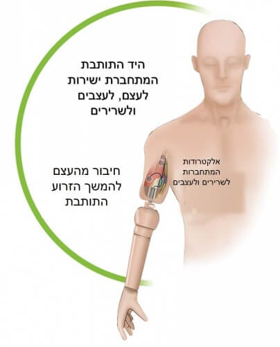אופן החיבור של הזרוע התותבת לגוף. מקור: Science Translational Medicine.