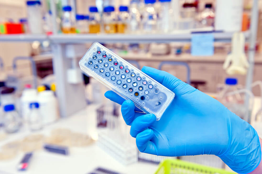 A laboratory device for detecting bacteria. Photo: shutterstock