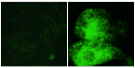 Fluorescence microscopy imaging of brown fat cells. The cells were marked when they transfected glucose 1 (GLUT1) (in green). The new signaling pathway was identified by discovering the way glucose transporters move from the inside to the outside of brown fat cells during stimulation.