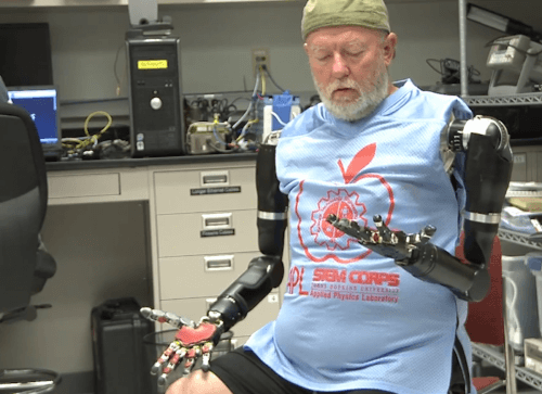 Leslie Bo, an amputee who was able to operate two robotic arms in Bo Zenamit for the first time. Photo: Johns Hopkins University