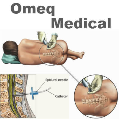 An explanation of the operation of the device for the correct insertion of an epidural, developed by the company Omoz Medical. PR photo