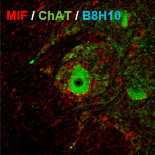 Very low expression level of MIF in motor neurons Photo: Dr. Adrian Israelson's laboratory team, Ben Gurion University