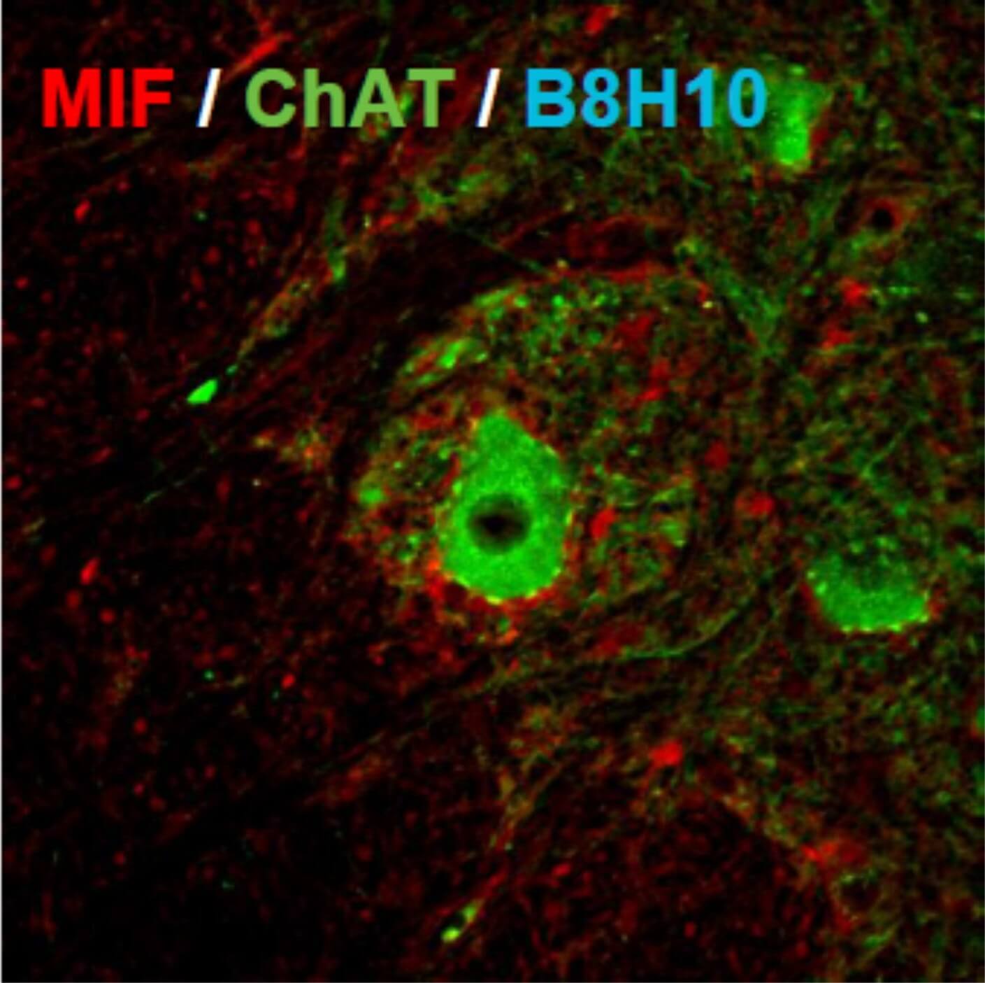 רמת ביטוי מאוד נמוכה של MIF בתאי עצב מוטוריים צילום: צוות מעבדתו של דר אדריאן ישראלסון, אוניברסיטת בן גוריון