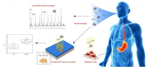 The diagnostic system developed by Prof. Hayek of the Technion to detect stomach cancer