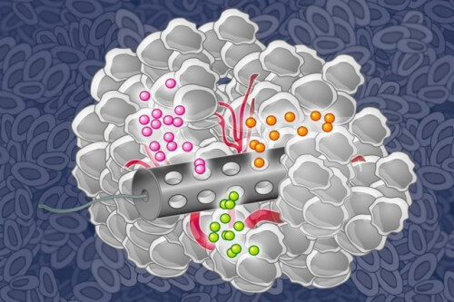 Chemical engineers from the Massachusetts Institute of Technology (MIT) have developed an implantable device capable of injecting many drugs into the body at the same time, which could help them identify the most effective drugs. [Courtesy of Eric Smith]