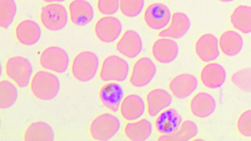 חומקים בעזרת מנגנון גנטי מורכב. טפילי מלאריה בכדוריות דם אדומות. צילום באדיבות פרופ' רון דזיקובסקי.