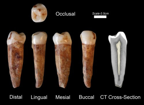 Findings of 400-year-old human teeth from Kesem Cave - credit Prof. Israel Hershkowitz