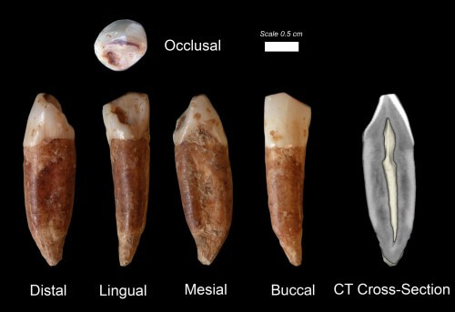 Findings of 400-year-old human teeth from Kesem Cave - credit Prof. Israel Hershkowitz