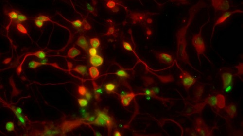 تغفو وتستيقظ. فيروسات VZV (مطلية باللون الأخضر) داخل ألياف الخلايا العصبية. تصوير: البروفيسور رون غولدشتاين، جامعة بار إيلان
