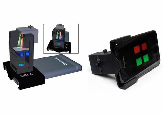 The cell phone-based microscopy device and interface developed at UCLA [courtesy Ozcan Group at UCLA]