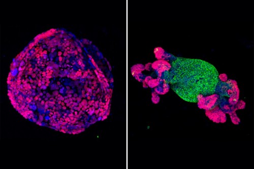 The APC gene is off on the left and on on the right, you can see that the tumor has shrunk. Image: Memorial Sloan Kettering Cancer Center