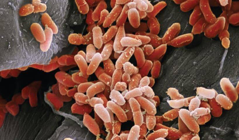 Enemy Group: The joint activities of Pseudomonas aeruginosa bacteria (above, in an electron microscope photograph) allow them to cause difficult-to-treat infections. Credit: Steve Geschmeissner Science Source