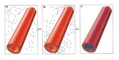 loading halloysite nanotubes with the drug from its saturated solution; (b,c mixing the mineral in the drug solution, removing air from the tubes, introducing the drugs into the nanotubes, washing the outer solution and getting nanotubes filled with the drug. [Courtesy: Yuri Lvov, Wencai Wang, Liqun Zhang, Rawil Fakhrullin]