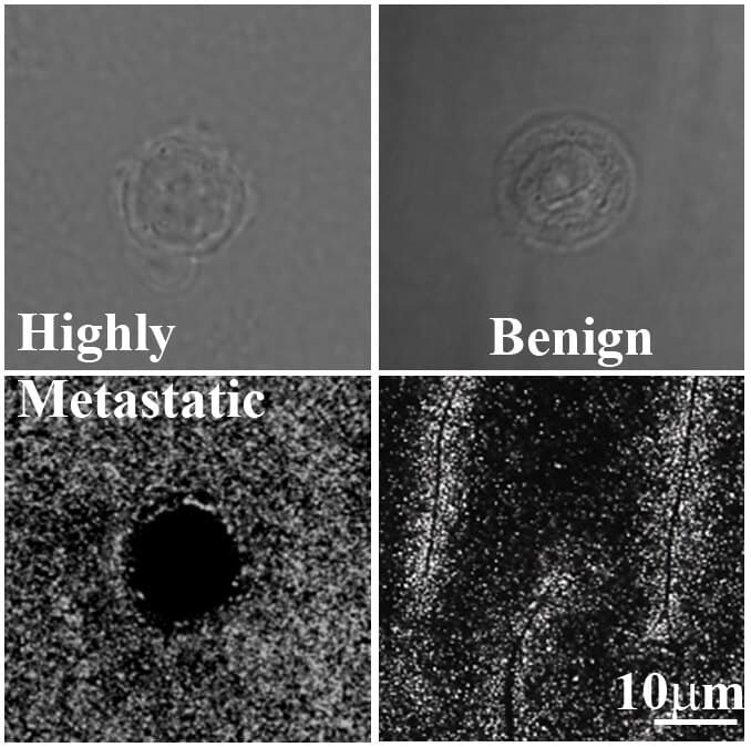 . Unlike the benign cells (right), the metastatic cells (left) manage to penetrate the gel and disappear inside it thanks to their unique properties