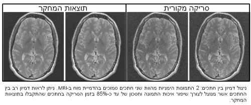 LIOR_MRI[1]