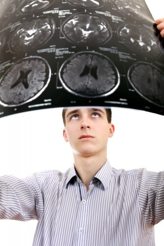 A teenager looks at his brain scan. Illustration: shutterstock