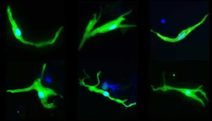 תצלום המראה דוגמאות לתאים קוצבי לב פרטניים [באדיבות: Vasanth Vedantham]