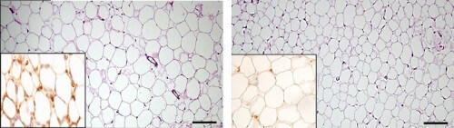 תאי רקמת השומן מוגדלים ומסודרים פחות מהרגיל בעכברים חסרי תאים דנדריטיים עתירי פרפורין (למעלה), לעומת אותה רקמה בעכברים רגילים (למטה). תמונה קטנה למטה משמאל: מבנים דמויי כתר בתוך רקמת השומן (למעלה, חום כהה) מצביעים על תהליך דלקתי מוגבר בתוך הרקמה
