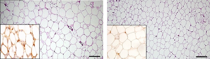 The adipose tissue cells are enlarged and arranged less than normal in mice lacking perforin-rich dendritic cells (above), compared to the same tissue in normal mice (below). Small image below left: crown-like structures within the adipose tissue (above, dark brown) indicate an increased inflammatory process within the tissue