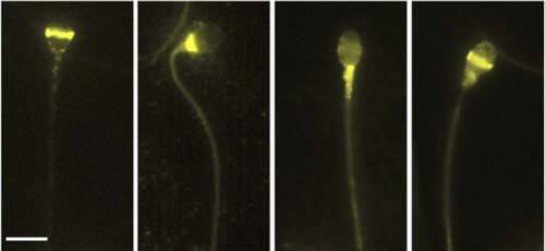 The different location of different opsins on a human sperm cell, as seen under a microscope, revealed by fluorescent antibody labeling (in bright yellow)