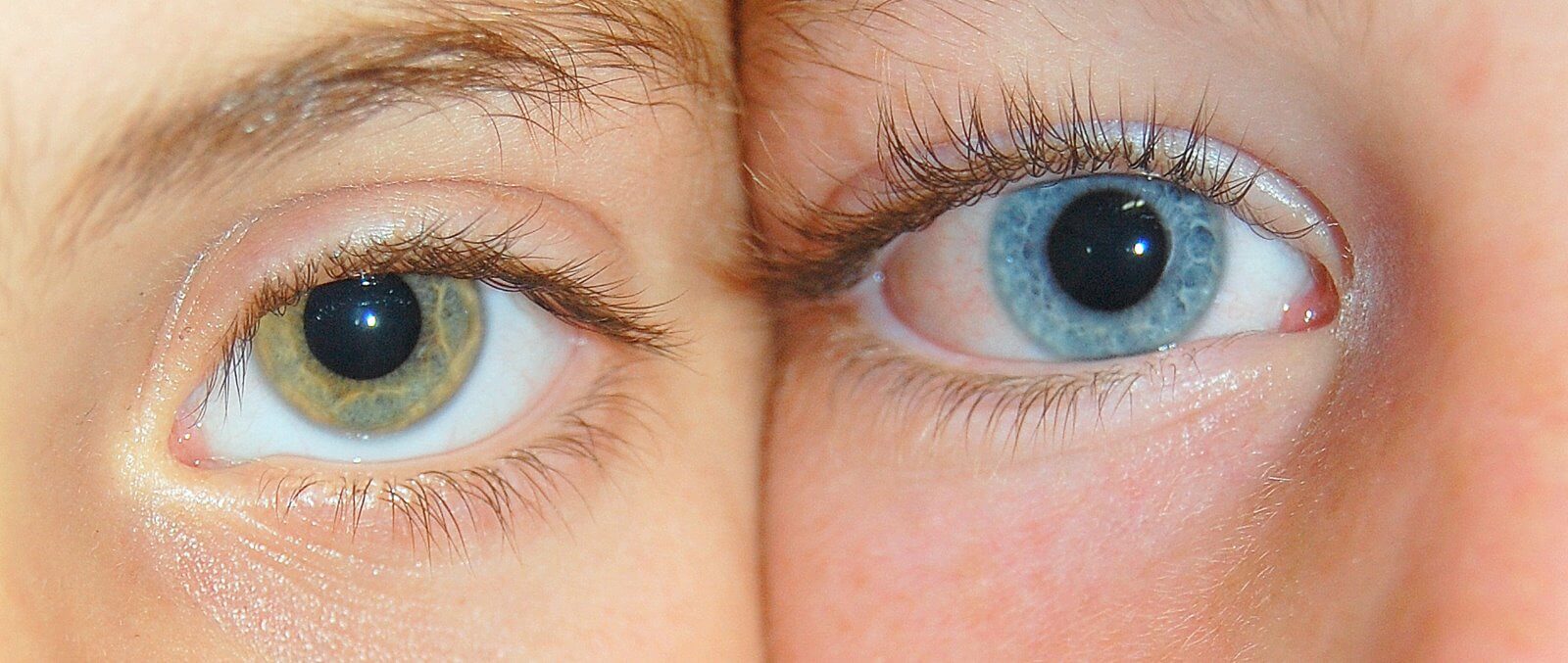A blue eye and a green eye. The differences between the photos are not only in the tone but also in the genome. From Wikipedia