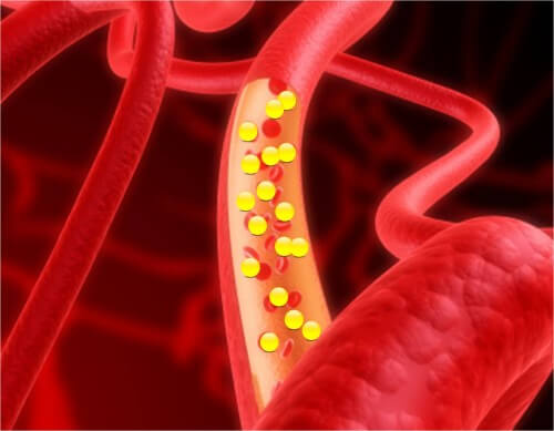 Gold nanoparticles for the treatment of atherosclerosis. Photo: PR