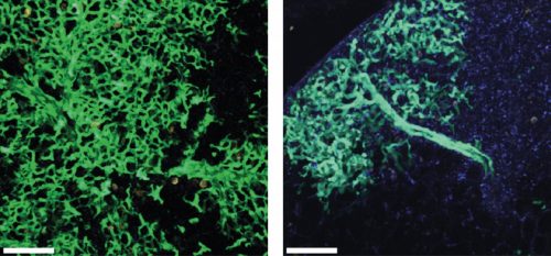 مقارنة بين حالة الرئة بعد ستة أسابيع من تاريخ زراعة الخلايا الجذعية (يمين)، وتطورها بعد 16 أسبوع (يسار). باللون الأخضر: الخلايا المشتقة من الخلايا الجذعية المزروعة على خلفية خلايا الرئة المزروعة، وهي ليست خضراء. وتظهر الصور التكوين المستمر لخلايا الرئة الجديدة، لتحل محل الخلايا التالفة. التصوير باستخدام مجهر ثنائي الفوتون