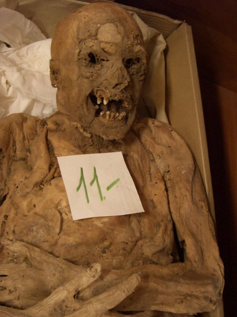 One of the mummies in the Vác collection courtesy of Dr. Ildiko Pap, Department of Anthropology, Hungarian Natural History Museum, Budapest.