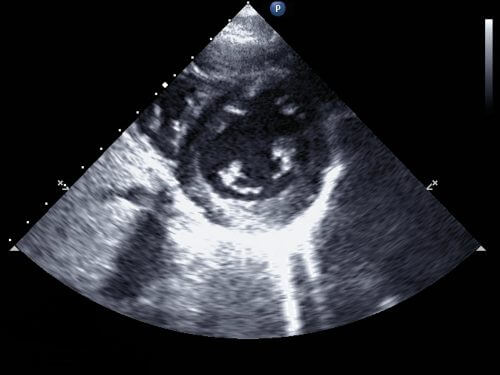 Echocardiography. Photo: shutterstock