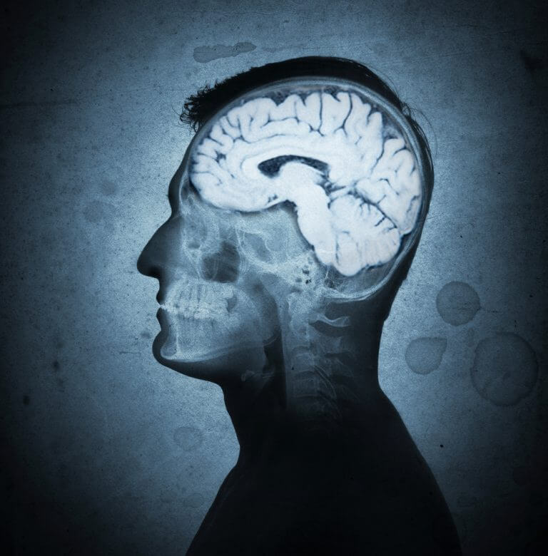the brain. Illustration: shutterstock