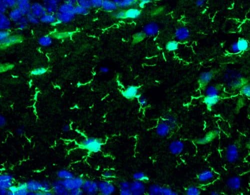 Microglia (in light green) in an adult mouse brain. Photographed using a fluorescence microscope