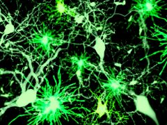 נוירונים (ירוק כהה) ותאי גליה (ירוק-צהבהב). איור: shutterstock