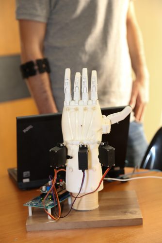 "Intuitive" prosthetic hand. Photo: Technion