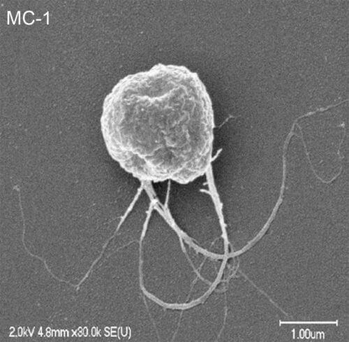 A bacterium that carries anti-cancer drugs. Photo: Montreal University of Technology