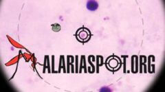 סמליל המשחק MALARIASPOT המאפשר גילוי מוקדם של מלריה במדינות מתפתחות.