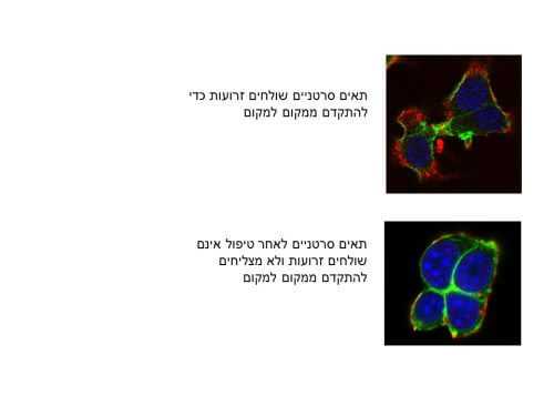 Research conducted at Tel Aviv University, in collaboration with a laboratory at MIT, uses genetic material of the micro-RNA type to 'silence' specific genes, which allow cancer cells to change their shape and migrate in the bloodstream to other areas of the body. The promising result: tumors in mice treated in this way did not metastasize!