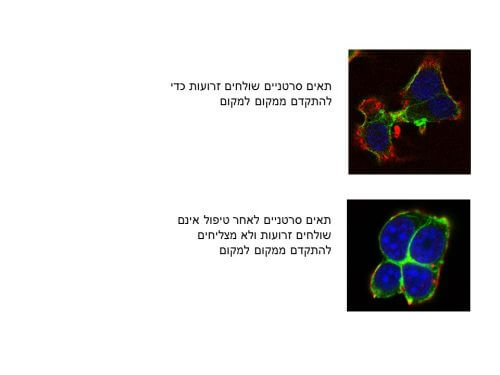 מחקר שנערך באוניברסיטת תל אביב, בשיתוף עם מעבדה ב-MIT, נעזר בחומר גנטי מסוג מיקרו- RNAכדי ל'השתיק' גנים ספציפיים, המאפשרים לתאים סרטניים לשנות את צורתם ולנדוד בזרם הדם אל אזורים אחרים בגוף. התוצאה המבטיחה: גידולים בעכברים שטופלו בדרך זו לא יצרו גרורות!