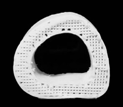 חתך רוחב של עצם ירך של אדם שהודפסה במדפסת תלת ממדית [באדיבות: Adam E. Jakus, Northwestern University]
