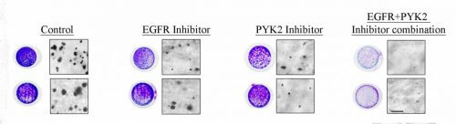 The combined treatment (right) significantly inhibited the growth of cancer cells (black/purple dots), compared to the treatment based on suppressing only one molecule. Source: Weizmann Institute magazine.