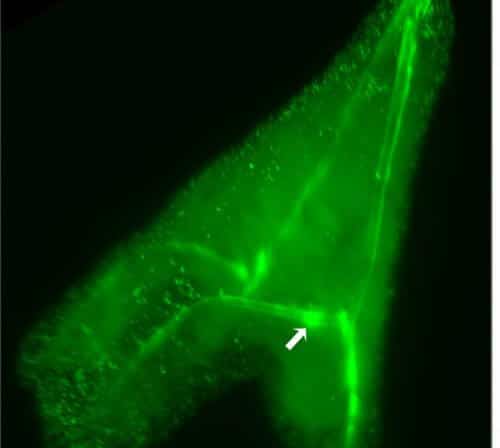 Mapping calcium distribution in sea urchin embryos by fluorescent labeling. The labeling shows tiny mineral spikes and bubbles with large amounts of calcium. Source: Weizmann Institute magazine.