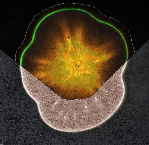 A cross section of a ripe tomato. In orange: distribution of sucrose in the flesh of the fruit. In green: one of the antioxidants produced in the peel. The substances were mapped in the fruit tissue using mass spectrometry imaging (MSI). Source: Weizmann Institute magazine.