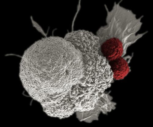 Electron microscope photo of T cells (in red) attacking a cancerous skin cell. Source: Rita Elena Serda, Duncan Comprehensive Cancer Center at Baylor College of Medicine, National Cancer Institute, National Institutes of Health / flickr