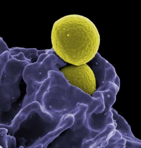 Staphylococcus aureus bacteria. Source: NIAID.