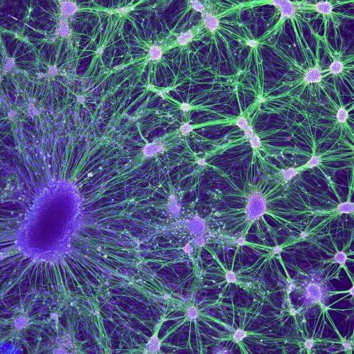 Neurons of a mouse embryo grown in a Petri dish. The axons, the extensions of the nerve cells, are the green extensions in the picture. Source: NIH.