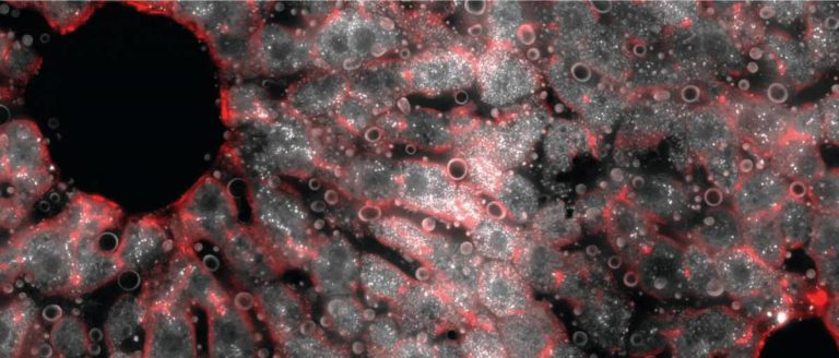 وعاء كبد الفأر. تم تصويرها باستخدام المجهر الفلوري. تحتوي الطبقة الوسطى على العديد من جزيئات الحمض النووي الريبي المرسال (النقاط البيضاء) التي تشفر بروتين الهيبسيدين، الذي ينظم مستويات الحديد في الدم. المصدر: من المقال - هالبيرن وآخرون، إعادة البناء المكاني للخلية الواحدة يكشف عن التقسيم العالمي للعمل في كبد الثدييات، طبيعة (2017).