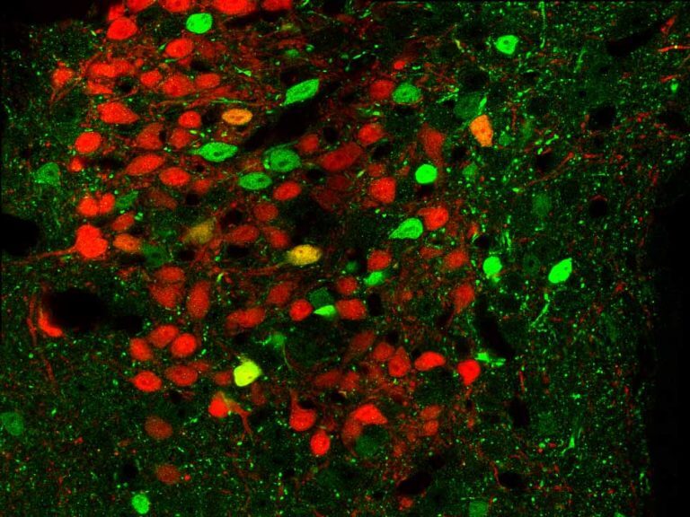 פרוסת מוח של עכבר מהונדס גנטית. תאי עצב שמבטאים את הקולטן CRFR1 מופיעים בירוק, ותאי העצב שמבטאים את המוליך העצבי CRF מופיעים באדום. התמונה צולמה במיקרוסקופ פלואורוסנטי. מקור: מתוך המאמר.