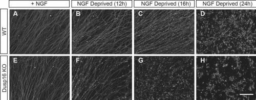 הרחקת גורמי גידול (NGF) מהמצע גורמת לפירוק עצבי של תאי עצב חסרי Dusp16 בשלב מוקדם יותר ובקצב מהיר יותר (שורה תחתונה); לעומת תאי העצב המקוריים (שורה עליונה), כפי שאפשר לראות בדגם הלא-רציף של צביעת האקסונים. מקור: מגזין מכון ויצמן.