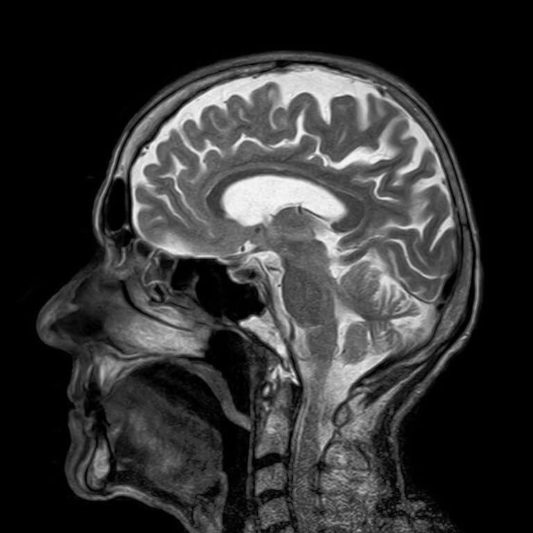 סריקת MRI. מקור: pixabay.com.