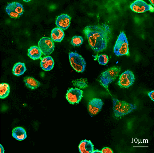 صورة مقطعية من مجهر متحد البؤر: خلايا سرطان الثدي ذات الإمكانات النقيلية العالية تندفع إلى هلام بولي أكريلاميد بصلابة تبلغ 2.4 كيلو باسكال، حيث يكون هذا القسم على عمق 10.6 ميكرون تحت سطح الجل. في الصورة يمكنك رؤية نواة الخلية (الأحمر)، وعنصر الأكتين في الهيكل العظمي داخل الخلايا (الأخضر)، واتصالات الخلايا بالسطح في مراكز الاتصال (الأزرق).